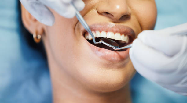 Best Weekend Emergency Dentist in Kelseyville, CA