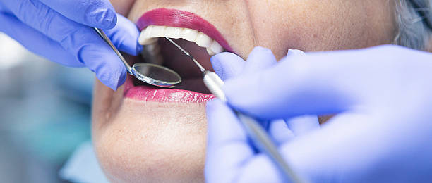 Best Emergency Treatment for Toothache in Kelseyville, CA